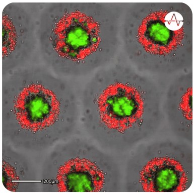 Organoid Analysis